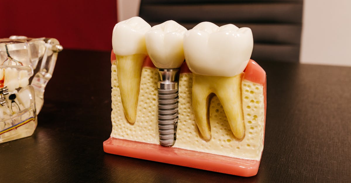 Dental Implants Johnstown